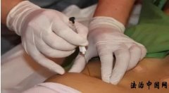 近400个穴位怎么记?(值得收藏)